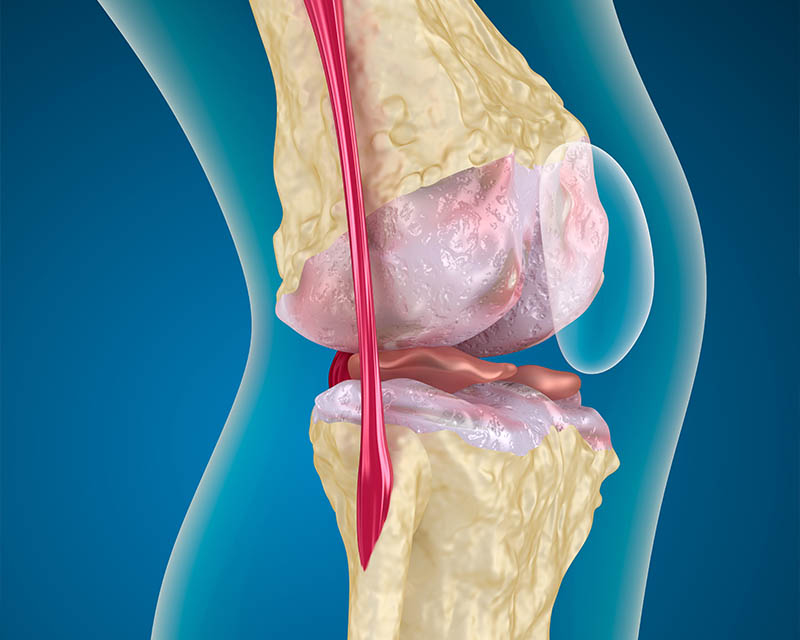 Exploring the secrets of osteoporosis